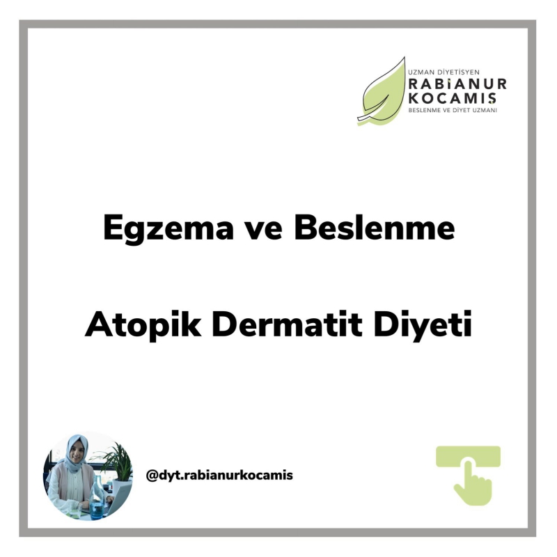 EGZEMA VE BESLENME  (ATOPİK DERMATİT DİYETİ)